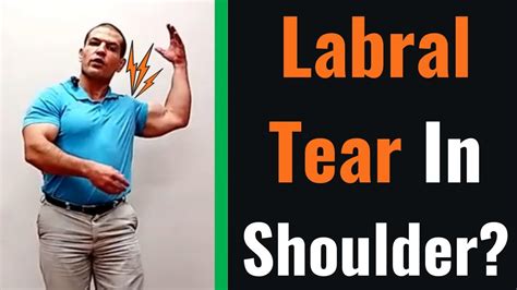 shoulder labrum tear treatment